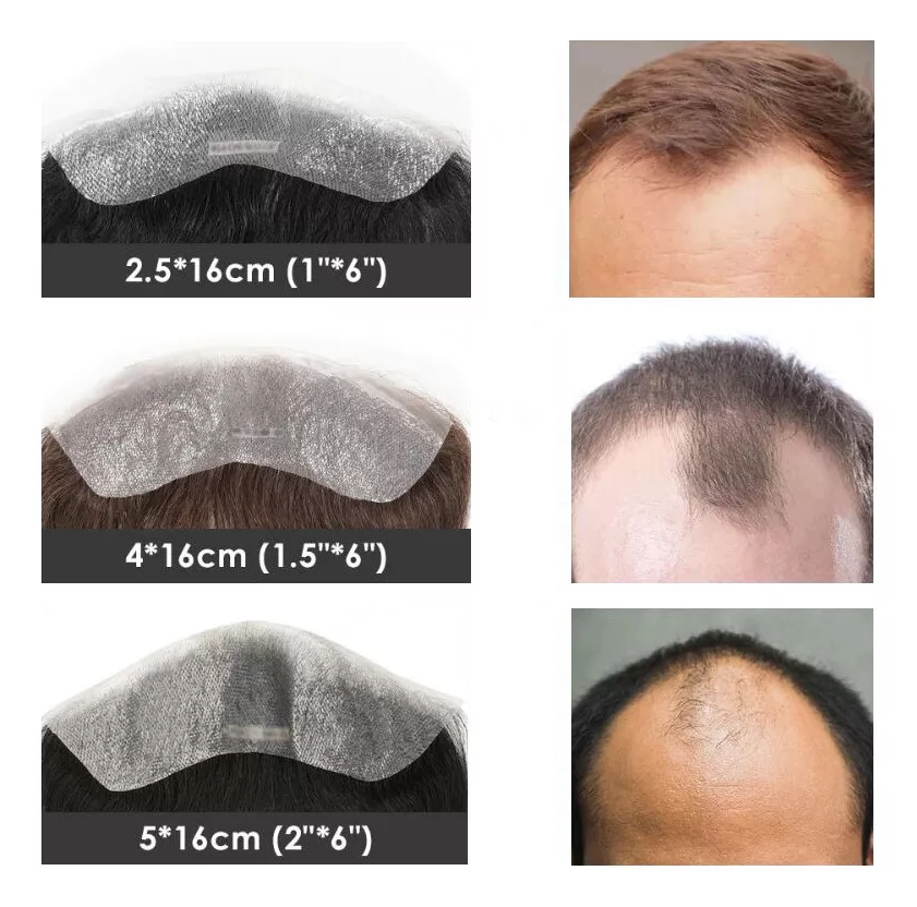 Nuevo 4 X16cm Sistema Capilar Frontal De Cabello Natural