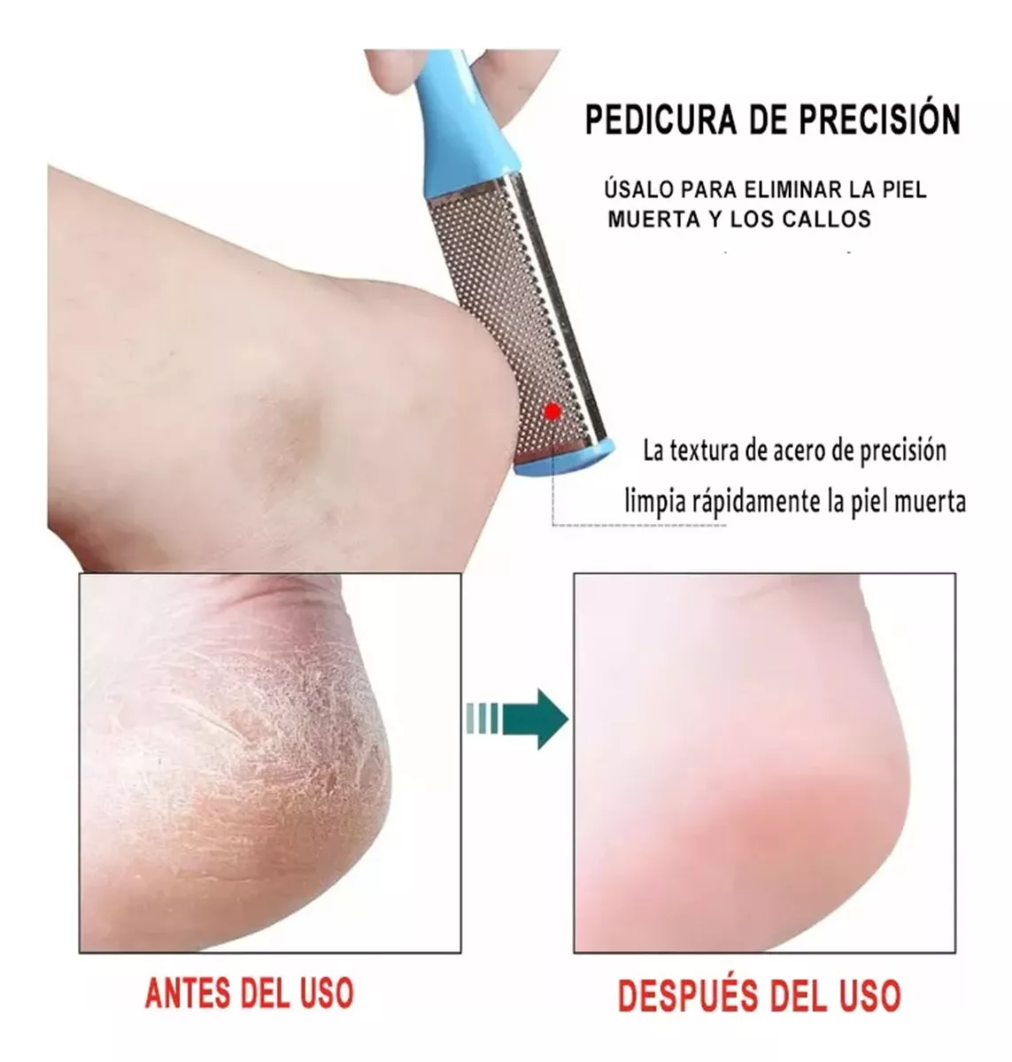 ICHIDO 13 Piezas Pedicure Set De Manicure Profesional Cortar Uñas Encarnadas.