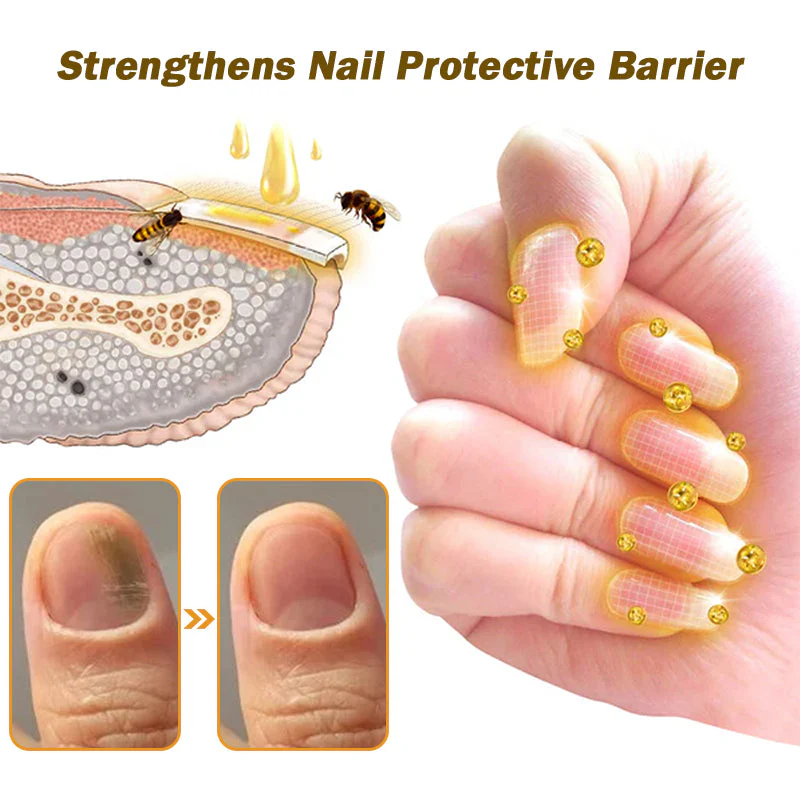 LOVILDS™ Nail Fungus Bee Poison Treatment Serum 🔥 🔥🔥 🔥🔥 🔥