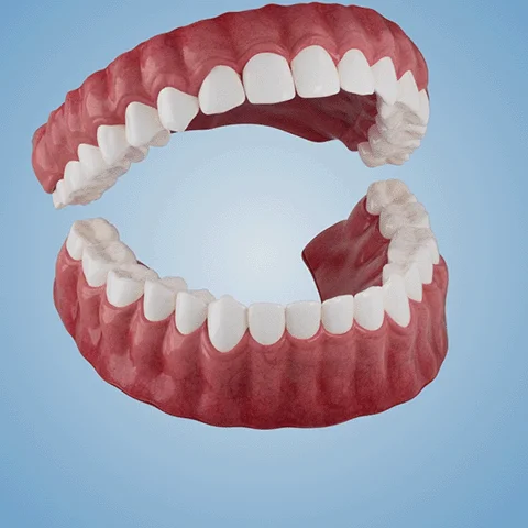 NESLEMY™-🦷Advanced Customized Full Denture Set🦷 (⏰Limited time discount last 30 minutes⏰)