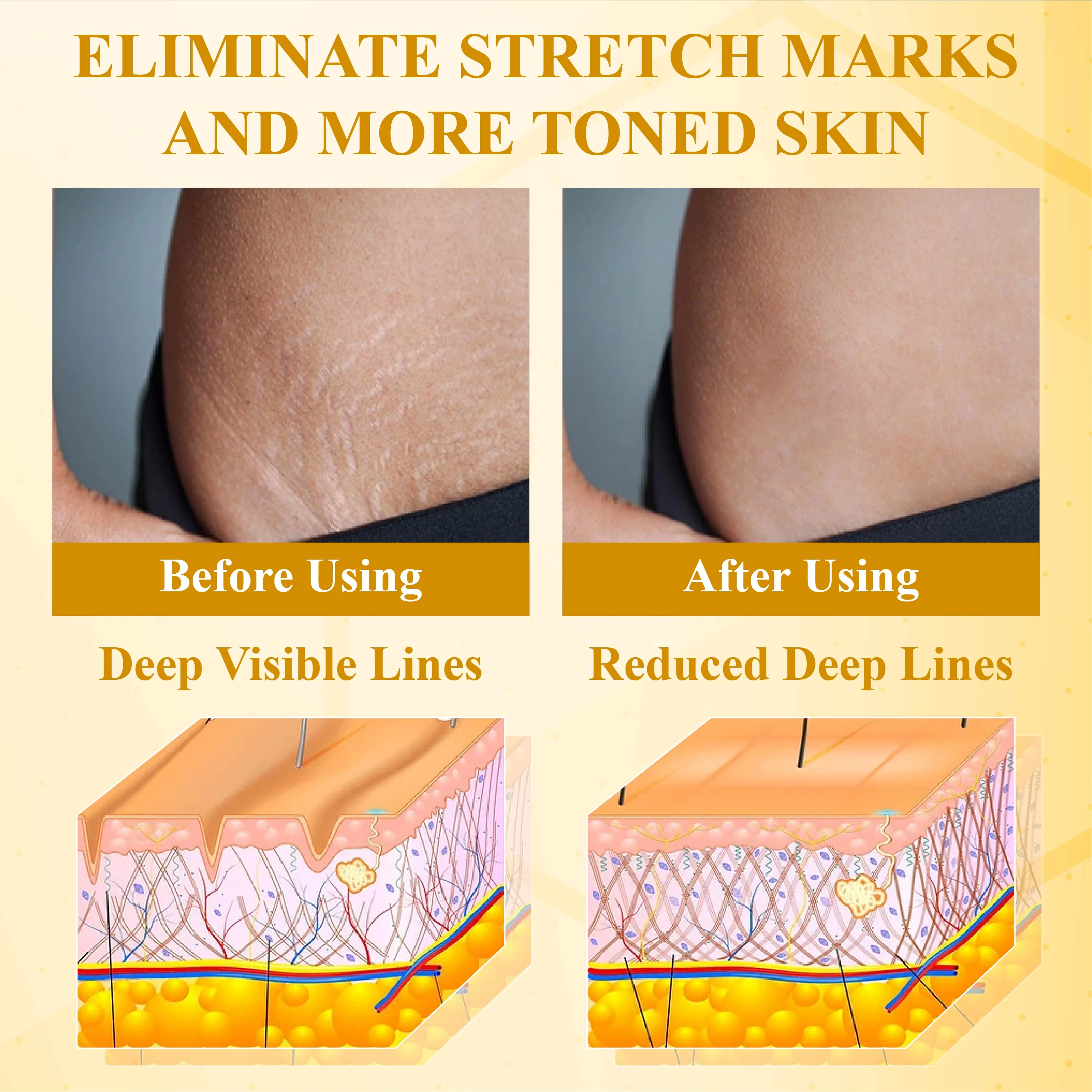 LOVILDS™  Bee Poison  Advanced Multi-Action FirmingCream