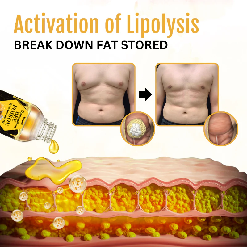 Histone™ ThermoFirm Bee Poison Gynecomastia Oil