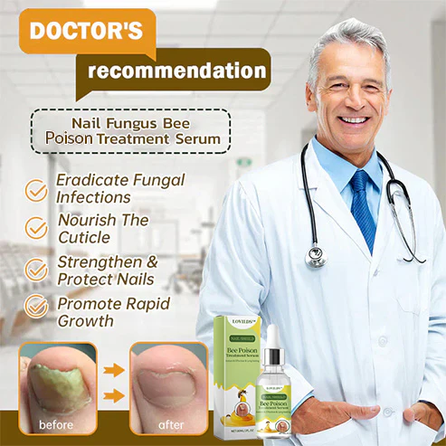 LOVILDS™ Nail Fungus Bee Poison Treatment Serum 🔥 🔥🔥 🔥🔥 🔥