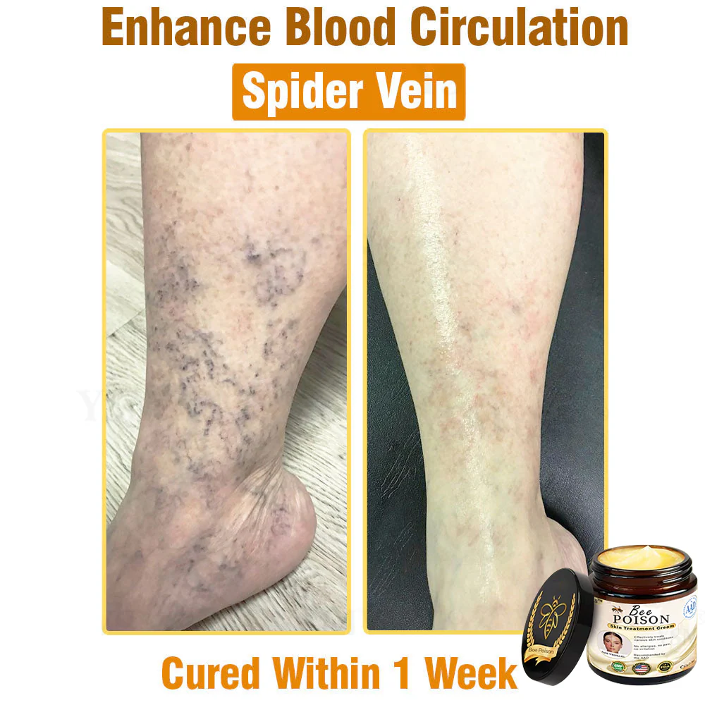 [Official Store] LOVILDS™ Full-Body Repair Cream: Anti-Aging, Hydration, Skin Repair, Even Tone, Acne & Dark Spot Treatment, Wart & Mole Removal, Psoriasis Relief