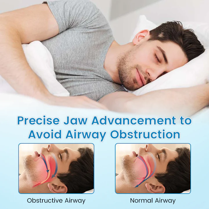 🌙 SLEEP PEACEFULLY, STRONG TEETH! 🦷 QIAWI™ Anti-snoring & anti-grinding mouthguard