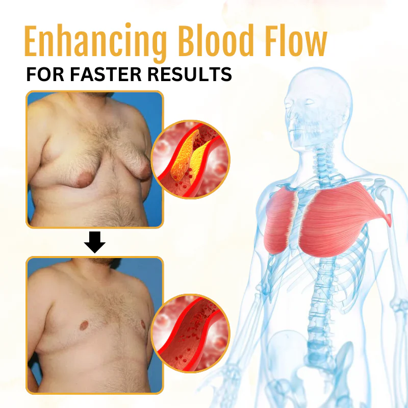 Histone™ ThermoFirm Bee Poison Gynecomastia Oil