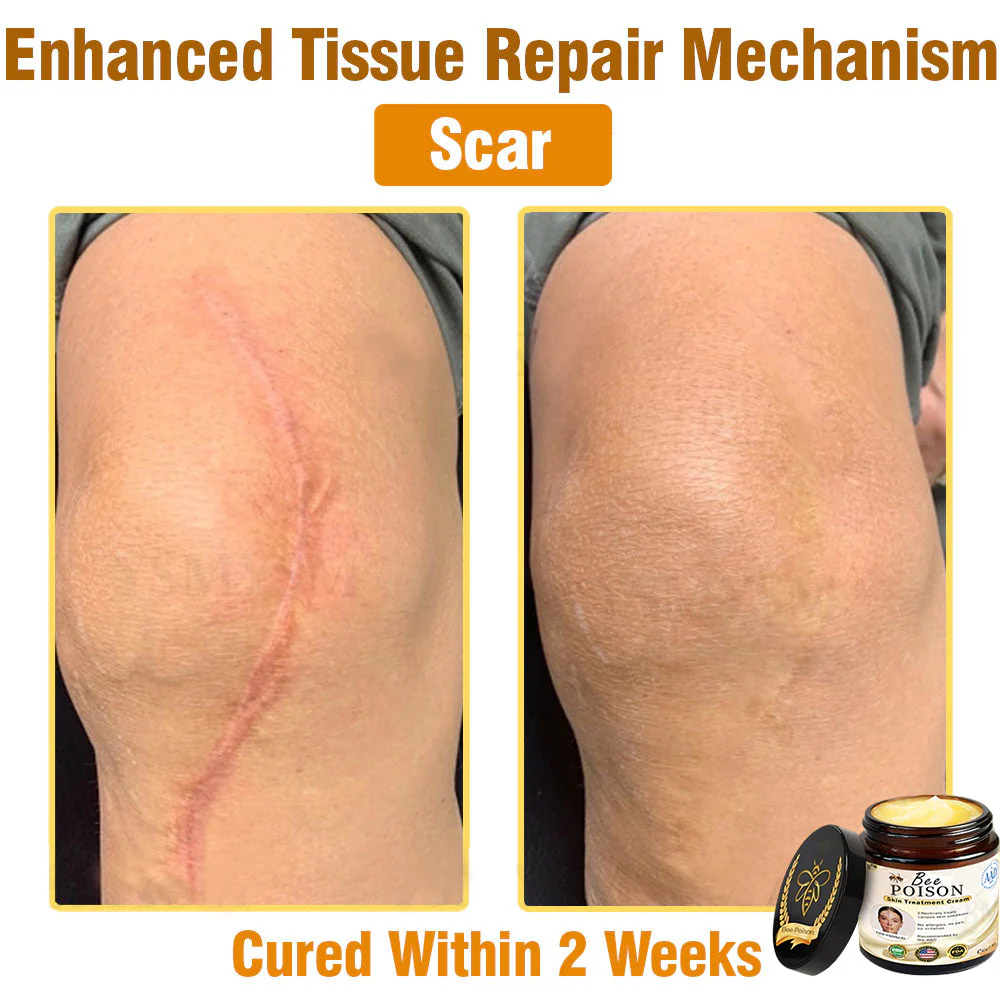 [Official Store] LOVILDS™ Full-Body Repair Cream: Anti-Aging, Hydration, Skin Repair, Even Tone, Acne & Dark Spot Treatment, Wart & Mole Removal, Psoriasis Relief