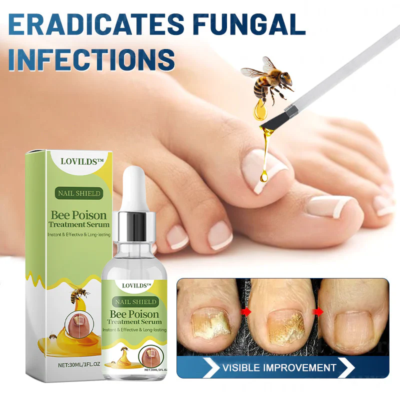 LOVILDS™ Nail Fungus Bee Poison Treatment Serum 🔥 🔥🔥 🔥🔥 🔥