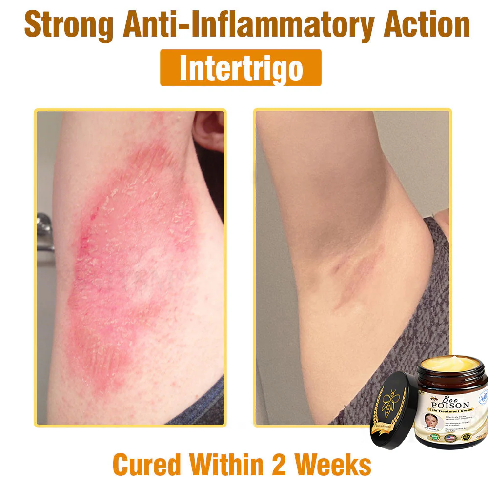 [Official Store] LOVILDS™ Full-Body Repair Cream: Anti-Aging, Hydration, Skin Repair, Even Tone, Acne & Dark Spot Treatment, Wart & Mole Removal, Psoriasis Relief