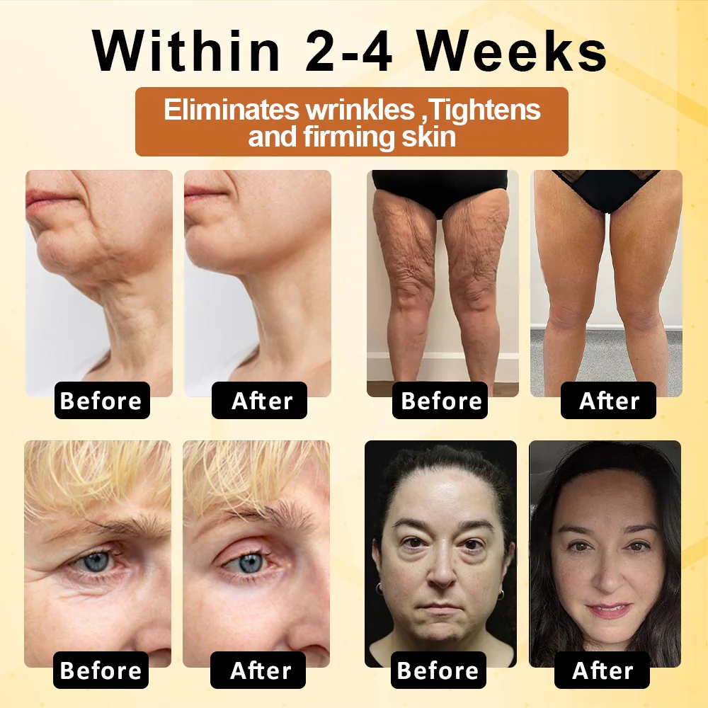 LOVILDS™  Bee Poison  Advanced Multi-Action FirmingCream