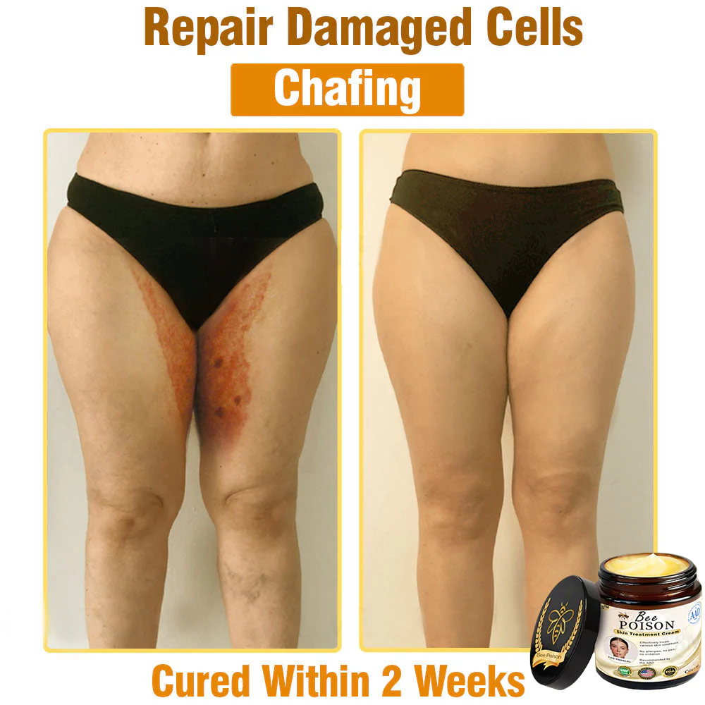 [Official Store] LOVILDS™ Full-Body Repair Cream: Anti-Aging, Hydration, Skin Repair, Even Tone, Acne & Dark Spot Treatment, Wart & Mole Removal, Psoriasis Relief