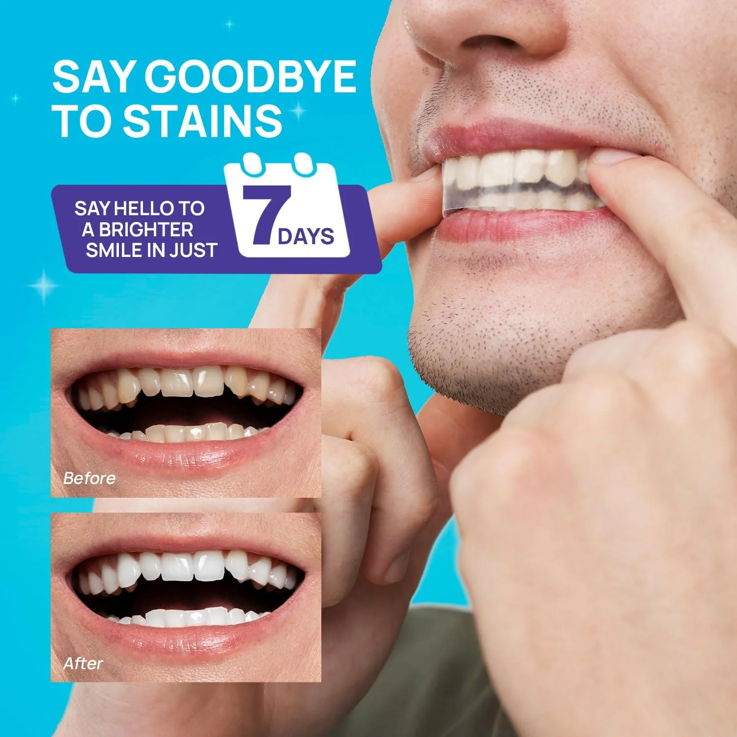 Whitebite Pro Upgraded Teeth Whitening Strips