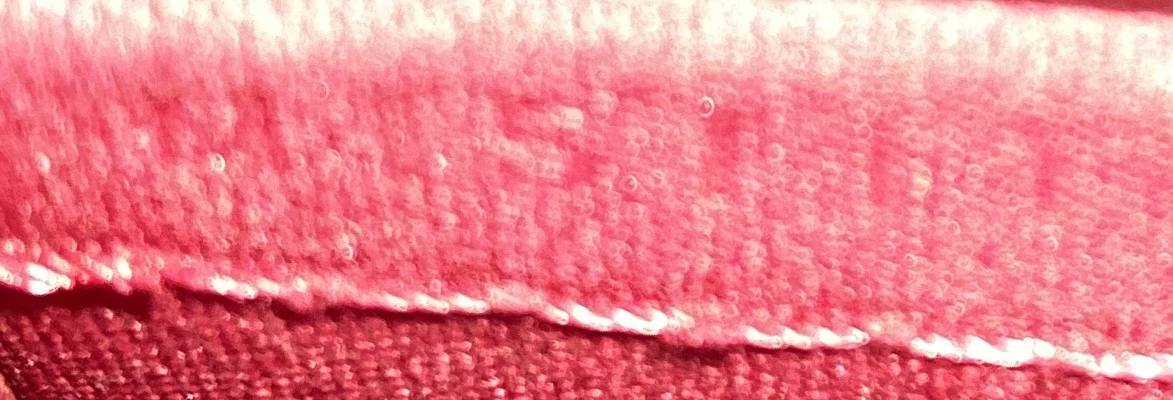 Alma Handbag Limited Edition Monogram Vernis Rayures BB - Deep Luxury