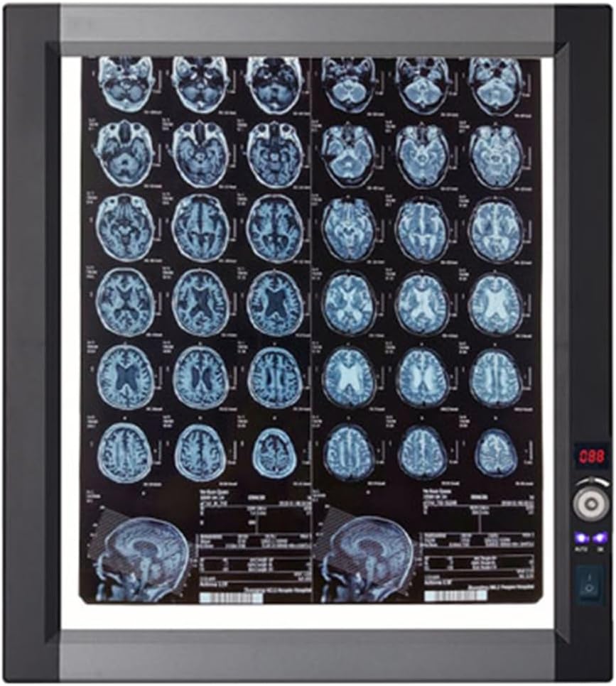 Lab Equipment X-Ray Film Illuminator Light Box X-Ray Viewer Light Panel Screen, Professional Tpc Slide Viewer Illuminator with Bracket and Optical Acrylic Diffuser for Home and Lab Use(19x19.5in/48x50