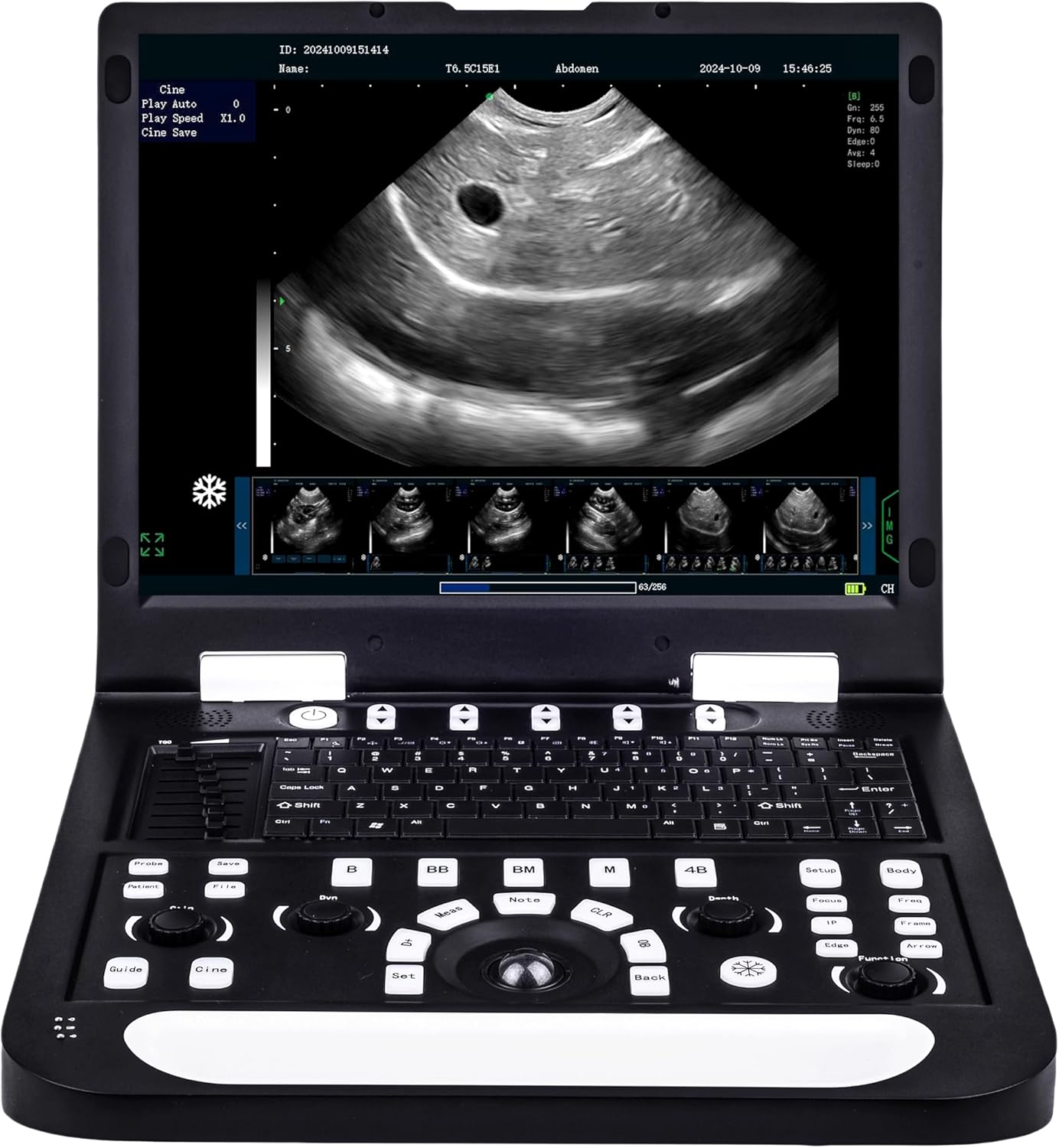 N60 Ultrasound Machine, PW upgradable, 15