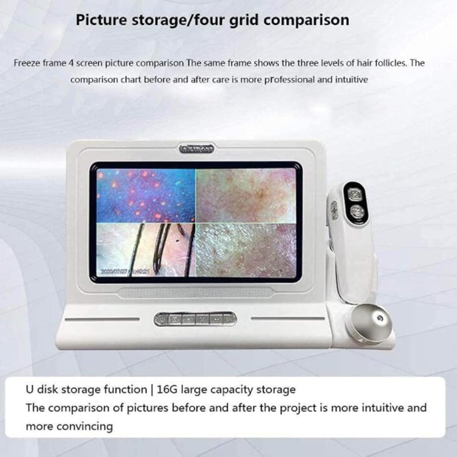 11 Inches Skin Diagnosis Hair Analyzer Machine with HD LCD Screen Digital Skin Detector Moisture Tester, Four-Picture Comparison & 16G Storage for Home Spa Salon Use