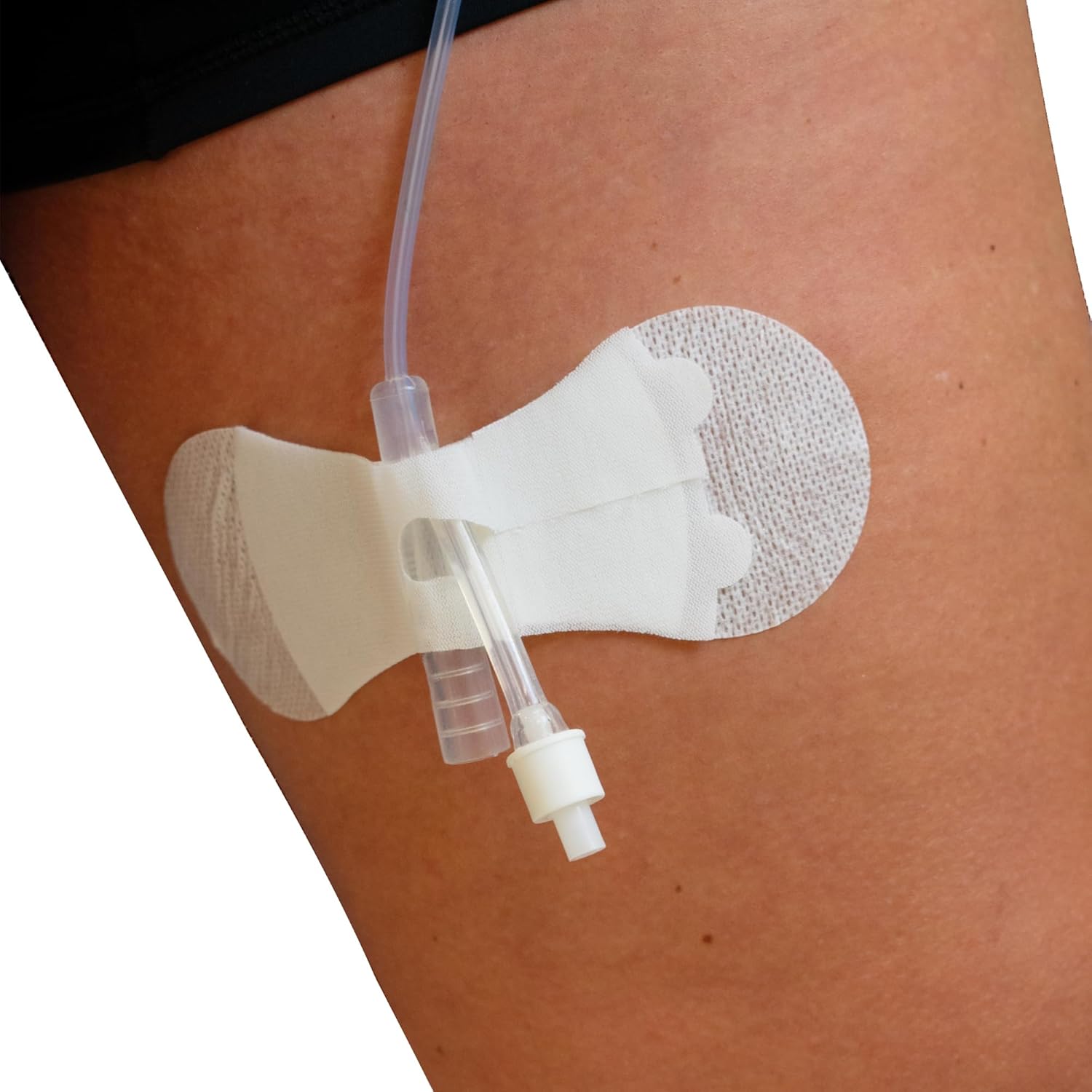 TIDI 3400LFC Grip-Lok Foley Catheter Securement Device ― Large ― Pack of 100 ― White ― Flexible Material ― Low-Profile Design for Comfort― Home Healthcare ― FSA Eligible Medical Supplies