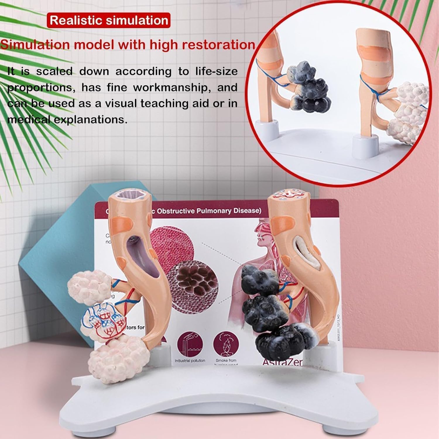 Human Alveolar Anatomical Model, Smoking Alveoli and Healthy Alveoli Comparison Model, Enlarged Alveolar Structure Model, with English Back Card, for Health Teaching