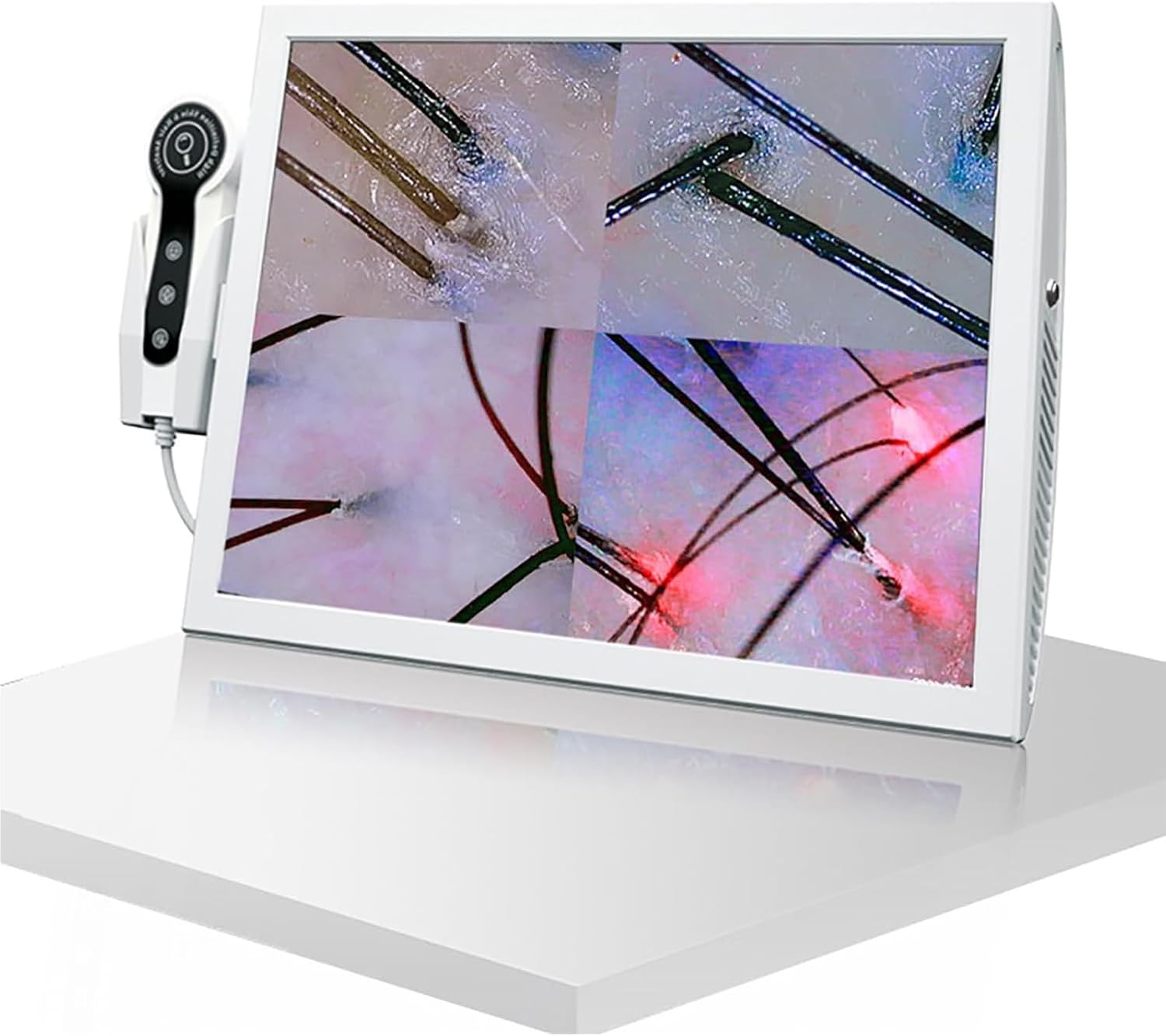 15Inch Multi-Functional Hair Follicle Skin Analyser, 70x/200x Scalp Detector Machine for Home & Salon Use, Professional Hair & Scalp Health Monitor