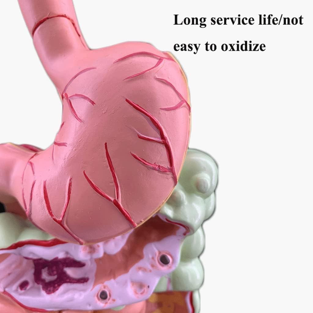 Large Intestine Pathological Model Pathological Anatomy Teaching Model Human Organ Model for Teaching Study Class Students