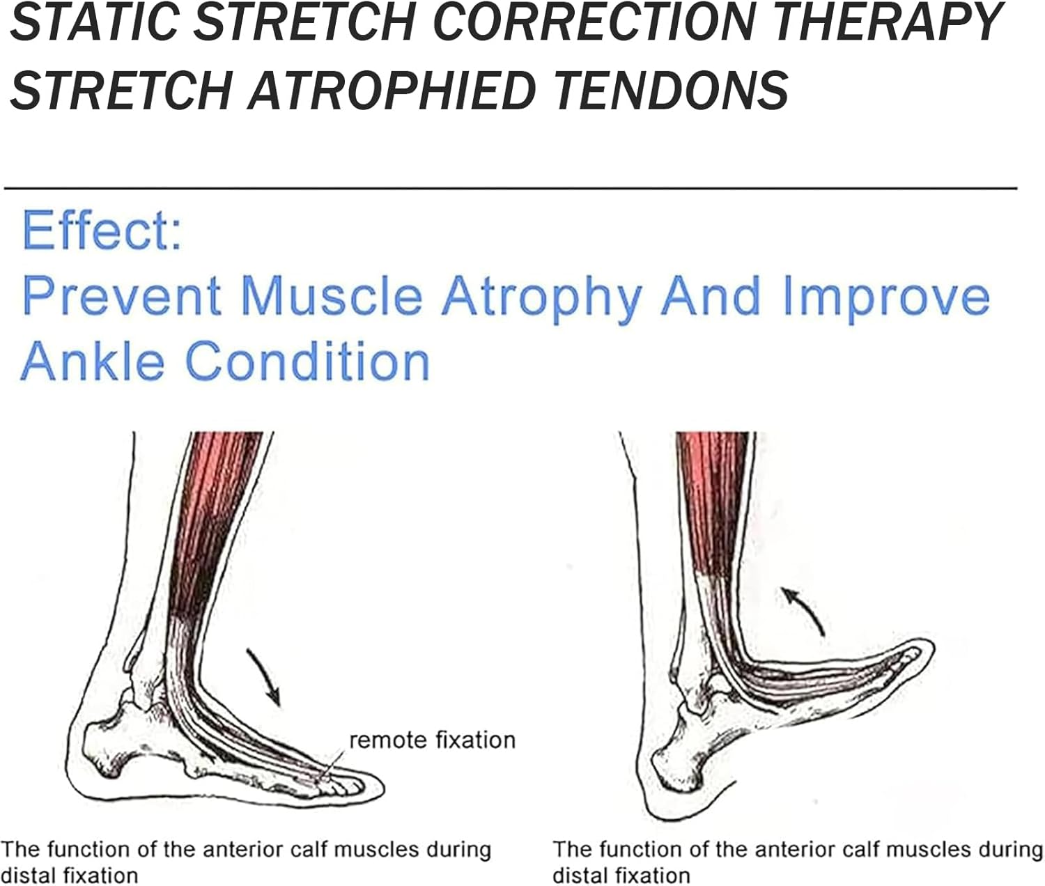 Ankle Rehabilitation Device, 0-40° (±5°) Full Angle Trainer Adjustable Angle and Intensity with Double Angle Dial for Ankle