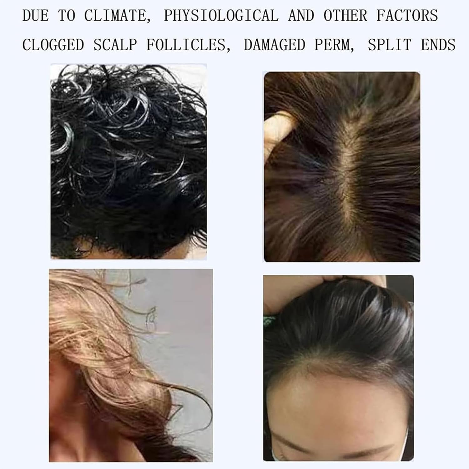 Skin Diagnosis Hair Analyzer, Digital Microscope Scalp Hair Follicle Detector, Freeze Frame Storage, Meridian Dredging and deep Massage, LCD Screen, Suitable for Home use, Salon spa