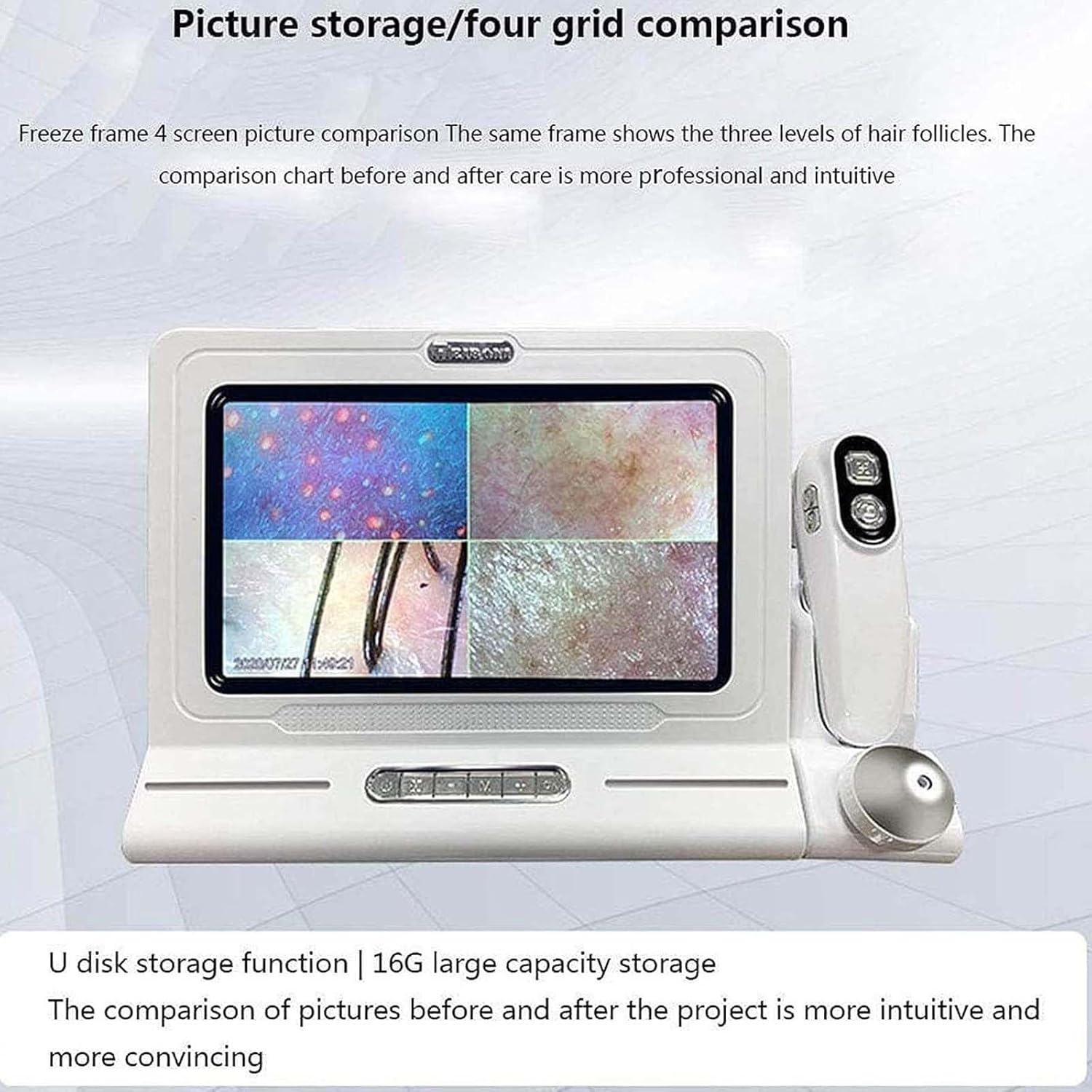 Skin Diagnosis Hair Analyzer Machine,50x/200x Skin Hair Scalp Detector,11-Inch Hd Display-10 Million Pixels,for Facial,Hairdressing,Scalp Care,Home,Beauty Salon