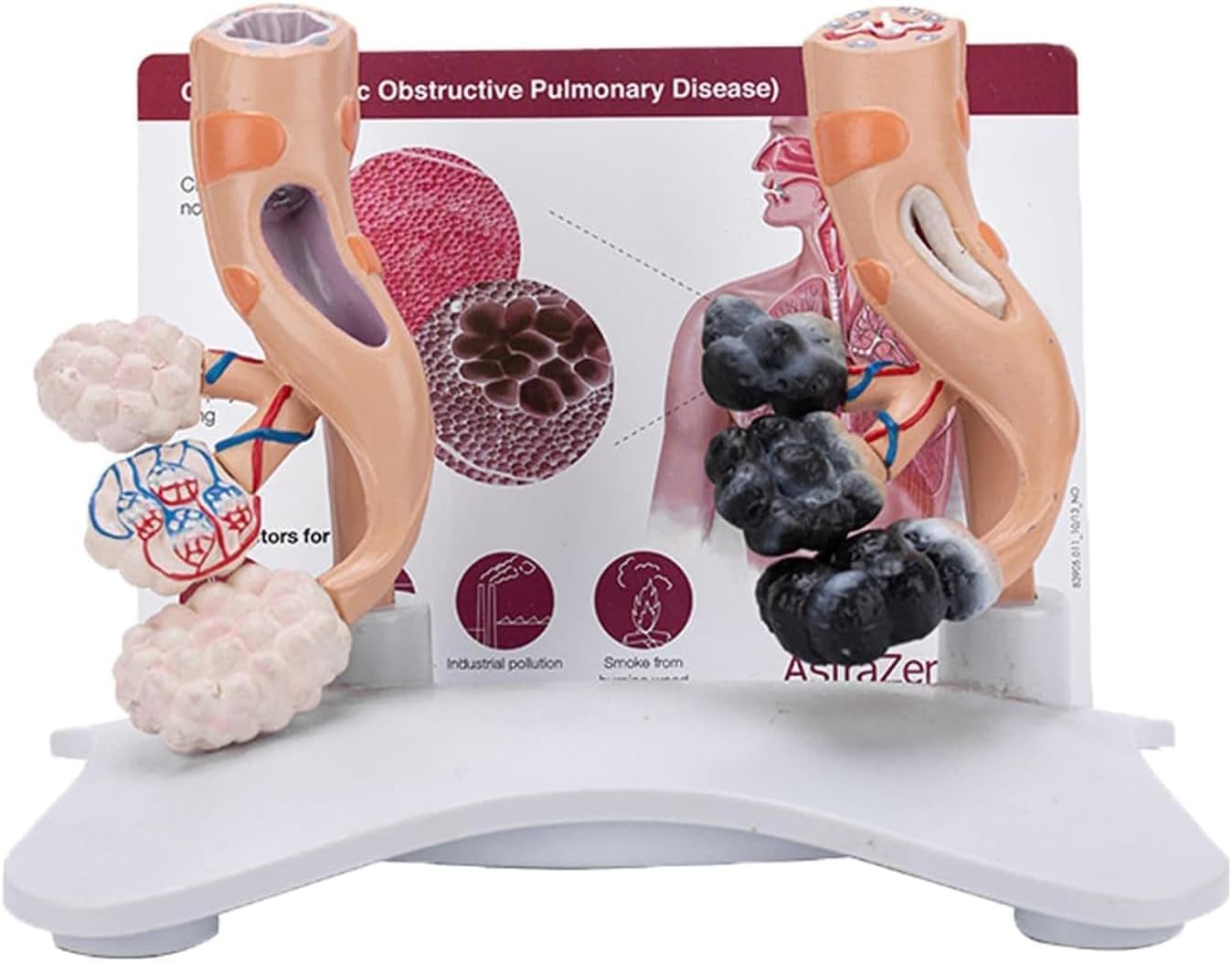 Human Alveolar Anatomical Model, Smoking Alveoli and Healthy Alveoli Comparison Model, Enlarged Alveolar Structure Model, with English Back Card, for Health Teaching