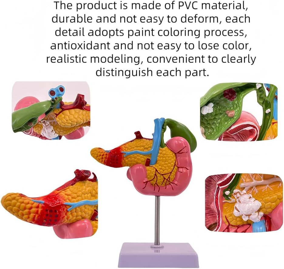 Hepatobiliary Pancreas Model with Gallstones - Gallbladder Surgery Training Kit - Medical School Teaching Aid for Gastroenterology
