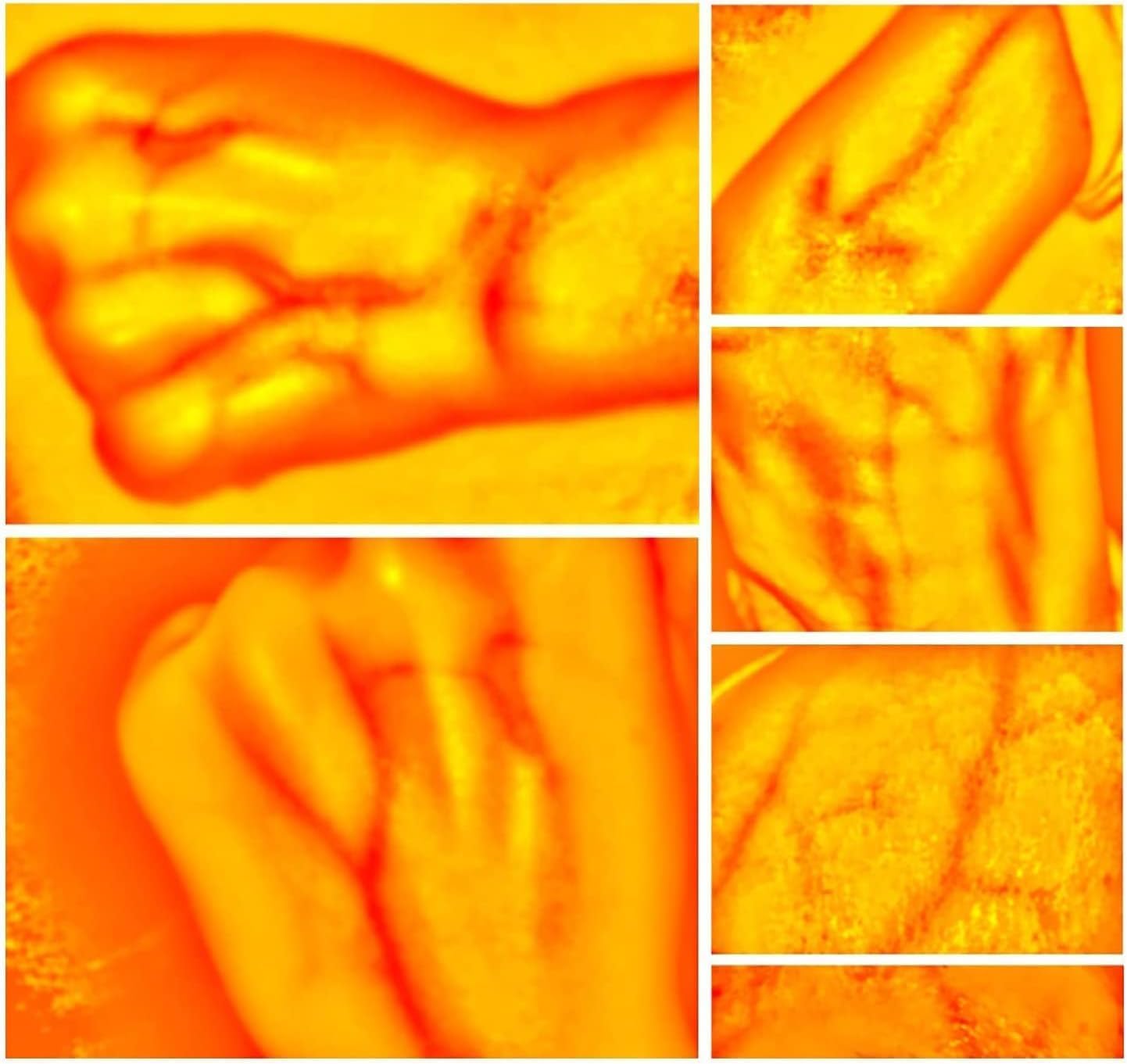 Adults Children Suitable Vein Viewer Display Lights Imaging Find Vein Medical Vein Finder Vein Viewer, for Hospitals
