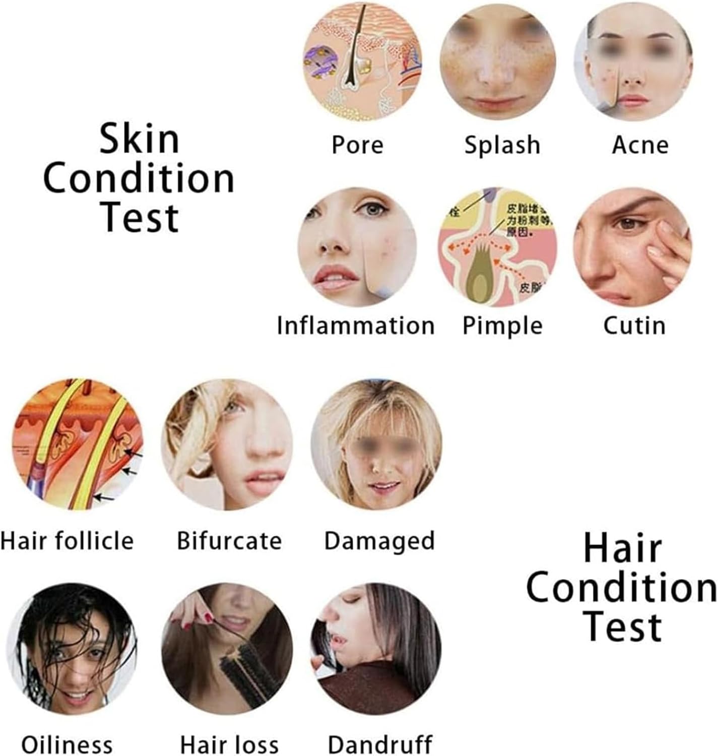 15Inch Multi-Functional Hair Follicle Skin Analyser, 70x/200x Scalp Detector Machine for Home & Salon Use, Professional Hair & Scalp Health Monitor