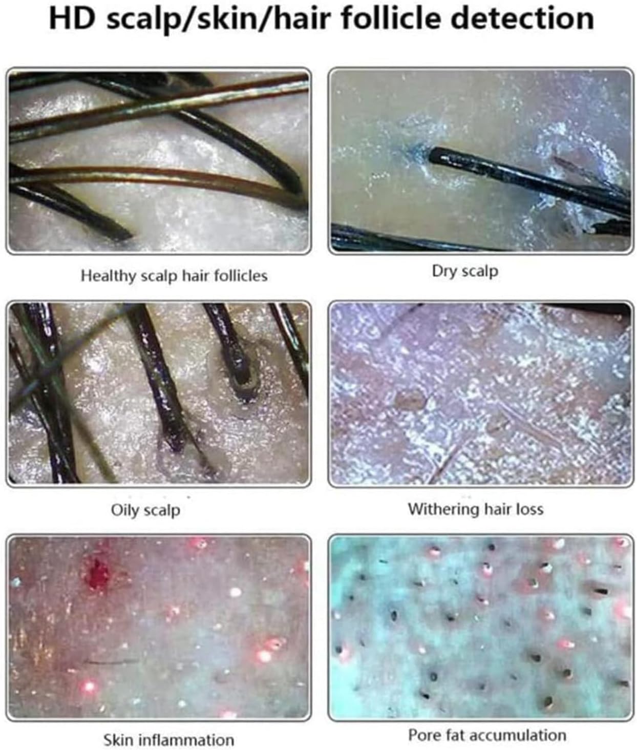 11 Inches Skin Diagnosis Hair Analyzer Machine with HD LCD Screen Digital Skin Detector Moisture Tester, Four-Picture Comparison & 16G Storage for Home Spa Salon Use