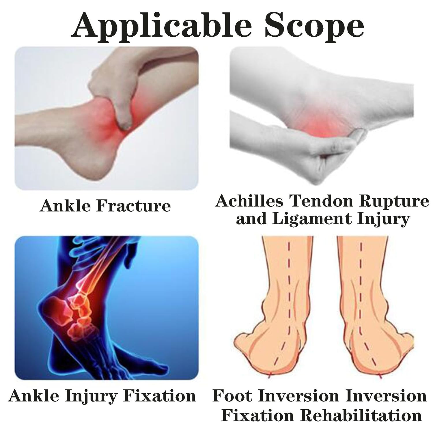 SFKLYU Kids AFO Drop Foot Brace, Pediatric AFO Night Splint, Ankle Foot Orthosis Night Splint for Children Toddler Ankle Foot Orthosis,1 Pair