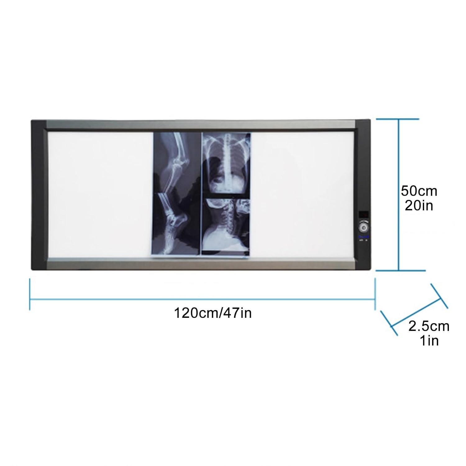 Portable X-Ray LED Film Viewer, 0-100% Adjustable Brightness, Wall Mounting View Box, Medical Imaging for Home, Hospital and Lab Use(50x120x2.5cm/20x47x1in)