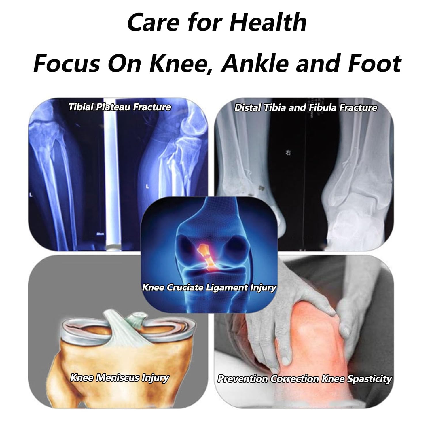 SFKLYU Kids Knee Immobilizer, Adjustable Knee Immobilizer Brace, Child Hinged Knee Brace, Guard Splint Leg Protector for Post OP Patella Injury Osteoarthritis,B Left