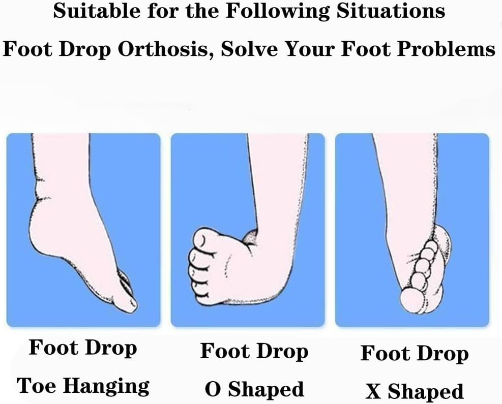 SFKLYU Othopedic Drop Foot, Ankle Stabilizer Brace, Sleeping Drop Foot Support, AFO Drop Foot Splint for Treating Plantar Fasciitis and Achilles Tendonitis,C a Pair