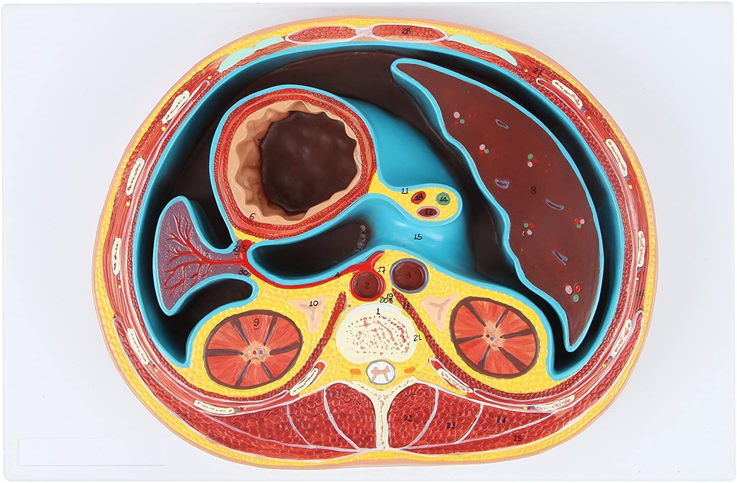 Human Anatomy Model of Abdominal Cross Section Lumbar Vertebra Human Thoracic Model Cross-Sectional Model of The Thoracic Cavity Urinary Teaching Anatomy Model