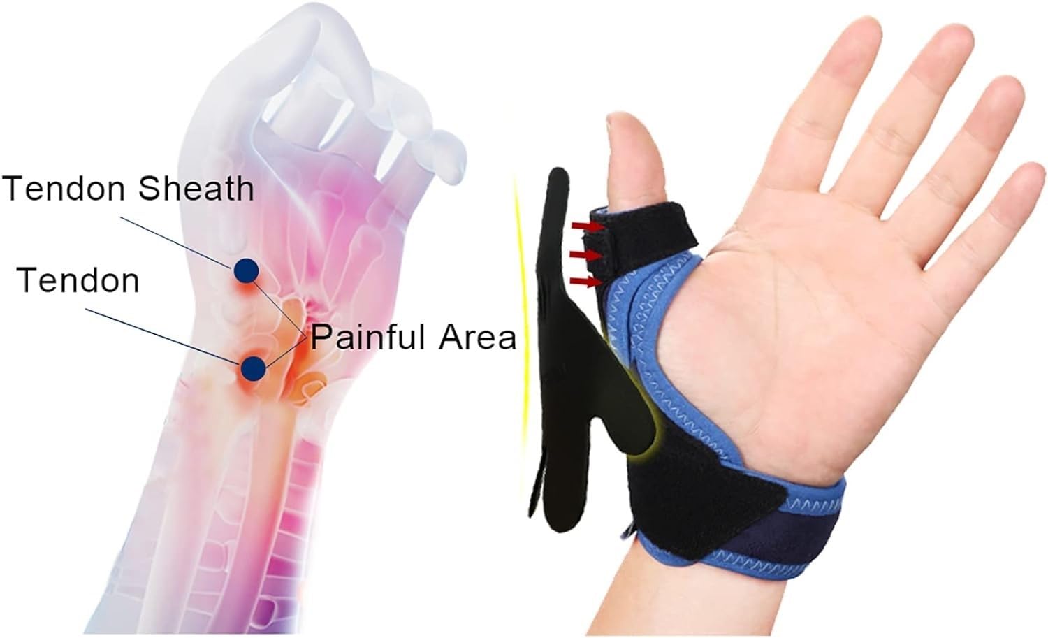 Thumb Bracers Joint Thumb Spica Splint Widened Strap Design Adjustable Elastic with Octopus Type Toughness Support Plate for Sprained,Tendonitis,Carpal Tunnel Hand Joint Pain Relief ( Color : Large )