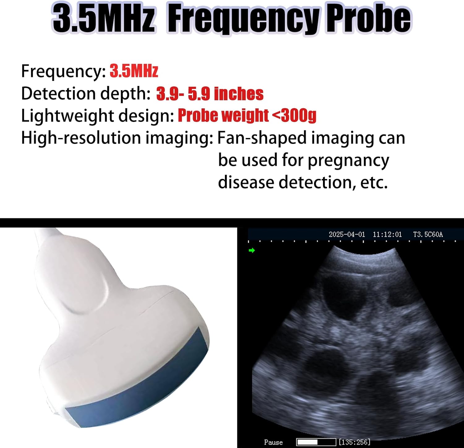 T1 8-inch Touch Screen Portable B-Ultrasound Machine is Equipped with Dual Probes is Suitable for Pregnancy examinations of Cats, Dogs, Pigs, Cattle and Sheep(Detection Depth 1.9”-8“)