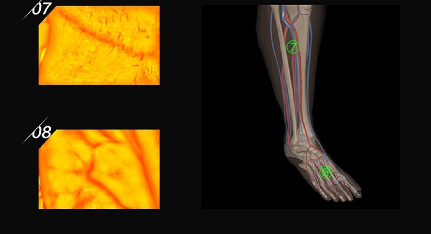 Adults Children Suitable Vein Viewer Display Lights Imaging Find Vein Medical Vein Finder Vein Viewer, for Hospitals