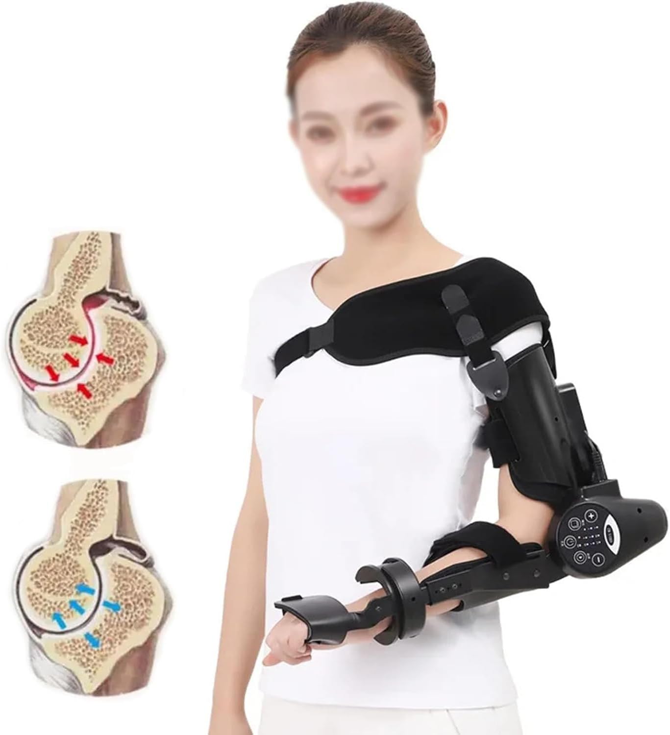 Brace Electric Elbow Joint Rehabilitation Device, Upper Limb Arm Rehabilitation Training Device, Precisely Control The Extension & Flexion Angle, for Stroke Hemiplegia Patients,Right