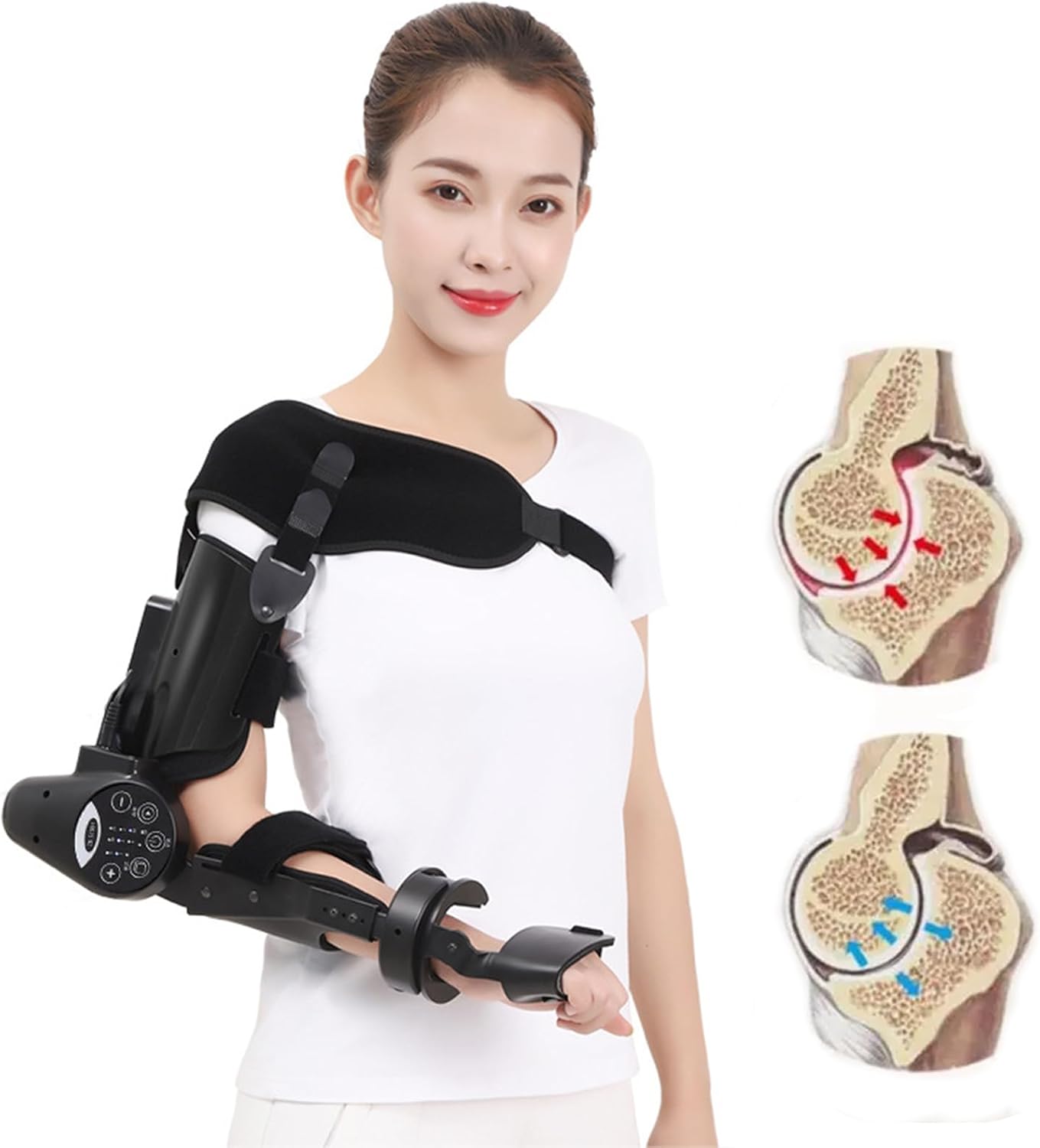 Arm Rehabilitation Device, Elbow Joint Rehabilitation Training Device Hinged Elbow Brace Arm Exerciser with Remote Control & Intelligent Timing for Stroke Hemiplegia Patients,Right