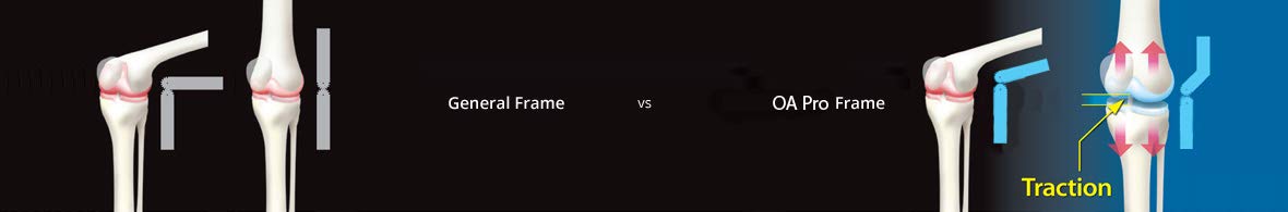 DDS, Inc. OA Pro Decompression Knee Braces - Arthritis Knee Support for Degeneration, Meniscus Tear, Bone-on-Bone Pressure Relief - Dual Unloading for Medial & Lateral Stability (Large)