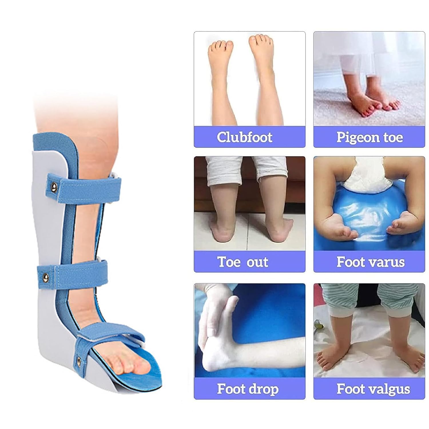 Children's Corrector, Ankle Posture Correction Brace, Calf Brace, Foot Support For Child Ankle Foot Orthosis Pediatric Night Splint Walking, Detachable Design, Easy To Clean S