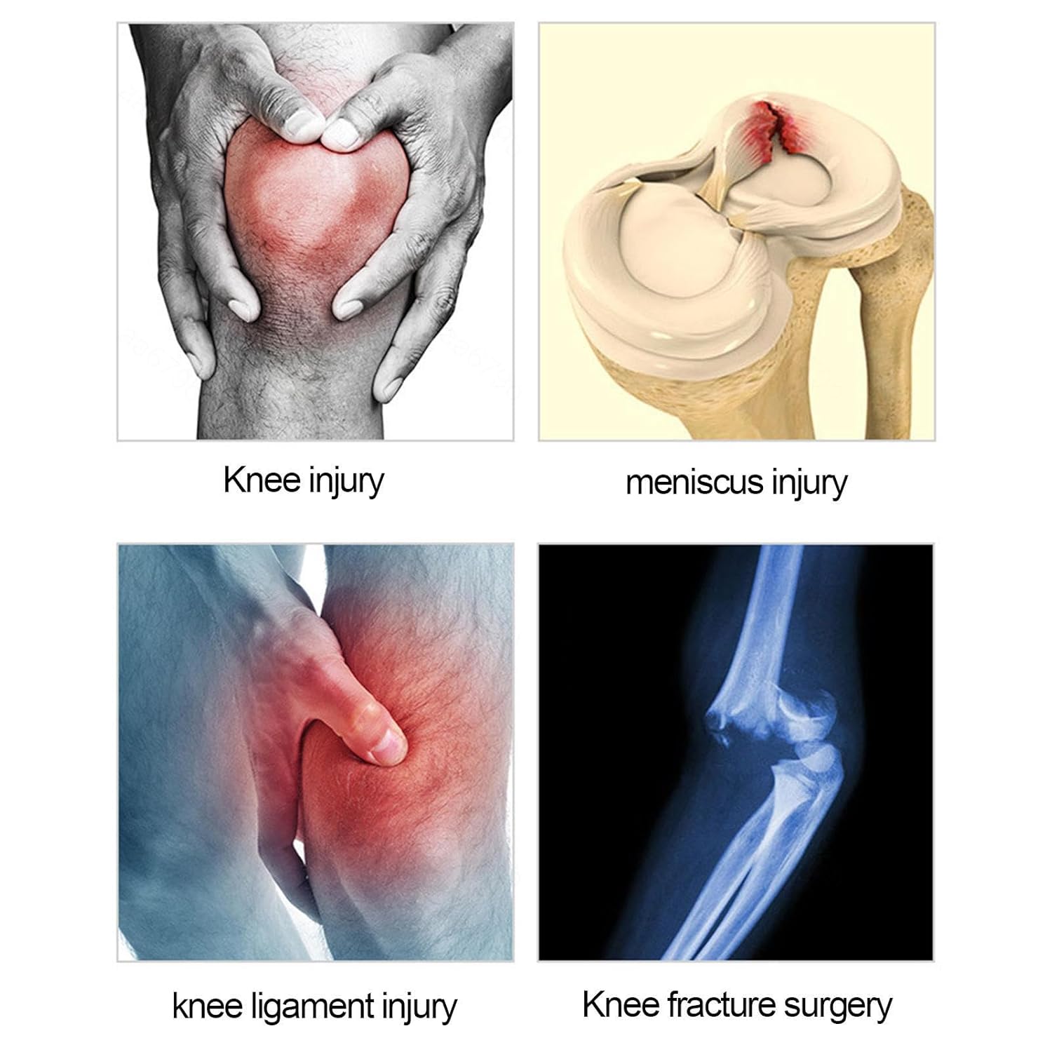 PopieL Adjustable Aluminum Alloy Knee Joint Brace Unisex Hinged Knee Brace Rehabilitation Brace After Meniscus Ligament Injury Left/Right Leg Knee Stabilizer