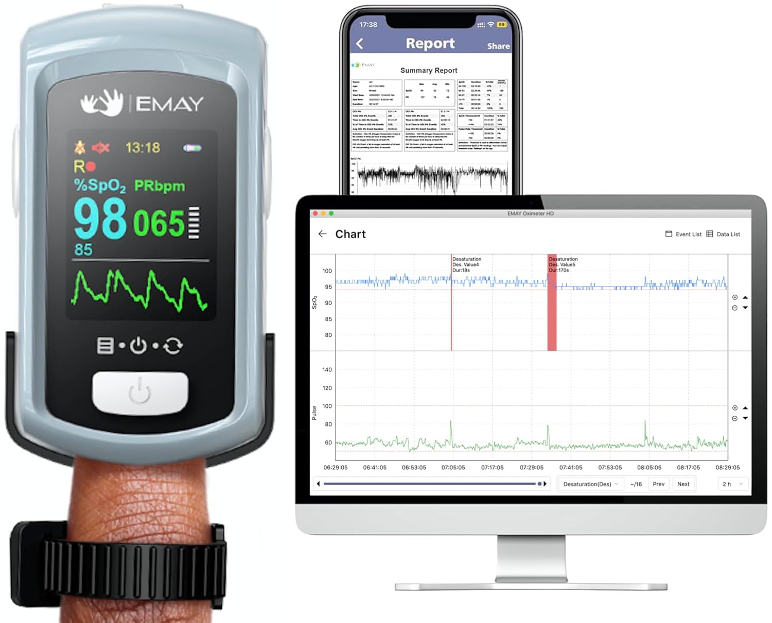 EMAY Sleep Oxygen Monitor with PC Software & App | Bluetooth Pulse Oximeter Rechargeable for Overnight & Continuous SpO2 Tracking with 72 Hours Built-in Memory | Gives Informative Report & Analysis