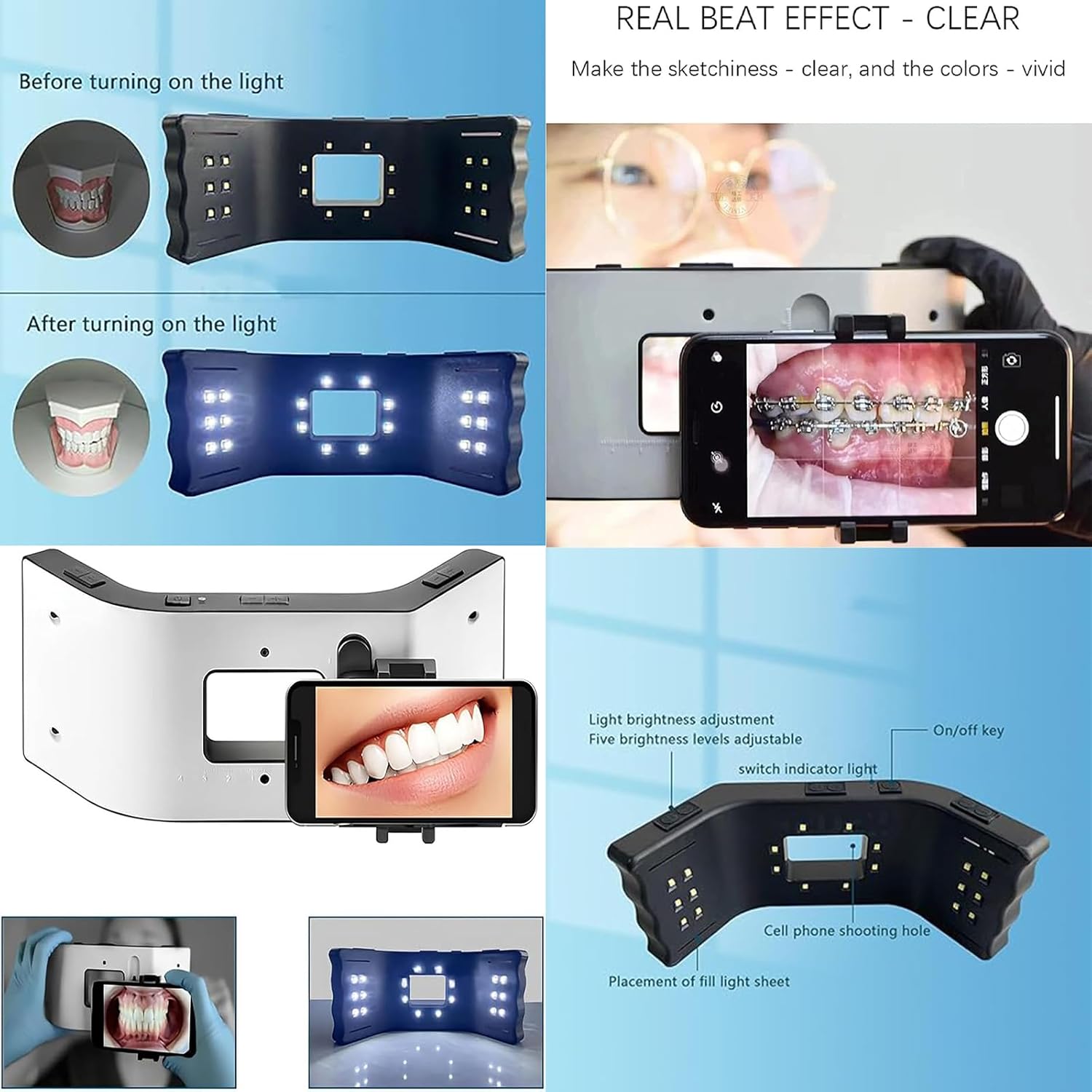 Dental Oral Led Photography Light, Dental Photography Light Kit, Oral Supplementary Lamp, 5 Gears Brightness Adjustable, 3D Surround Lighting, for Oral Photo Assistance