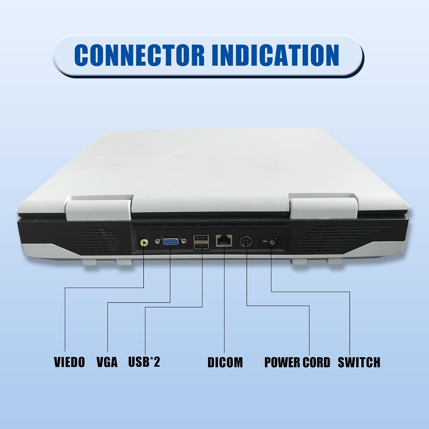 N60 Ultrasound Machine, PW upgradable, 15