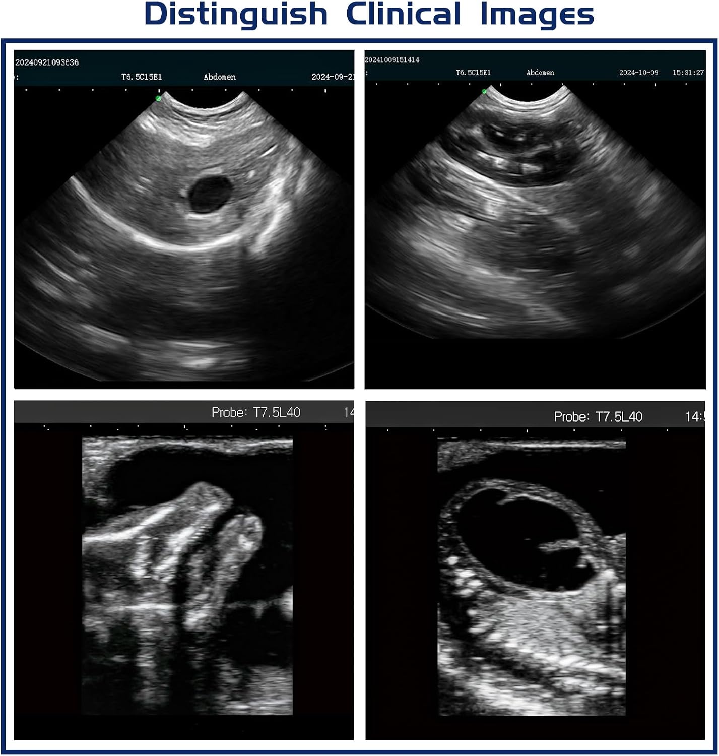 N60 Ultrasound Machine, PW upgradable, 15