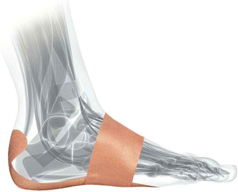 MUELLER Sports Medicine PFTape, Plantar Fasciitis Pain Relief Athletic Tape, Therapeutic Support for the Foot, Disposable, Latex Free, 56 One-Time Use Bandages